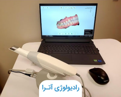 اسکنر داخل دهانی (3D scan) چیست؟