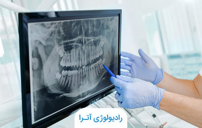 متخصص رادیولوژی فک و صورت یا radiologist چه کسی است؟