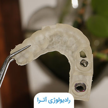سرجیکال گاید ایمپلنت در شیراز؛ فرایند ساخت و انواع آن